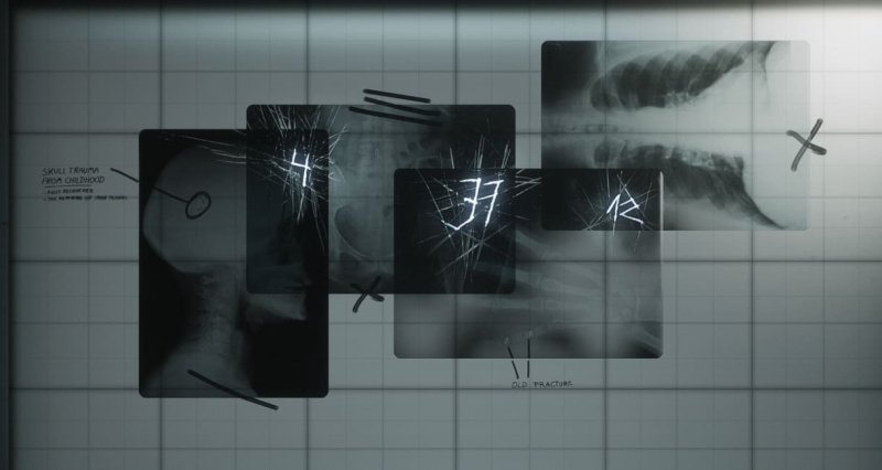 Silent Hill 2 головоломка с рукой в больнице брукхейвен