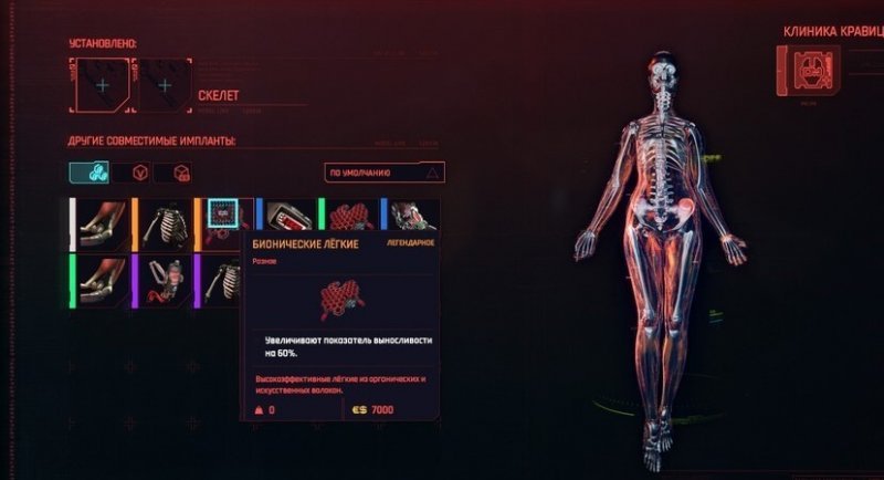 Cyberpunk 2077 легендарные импланты 39