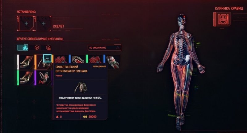 Cyberpunk 2077 легендарные импланты 38