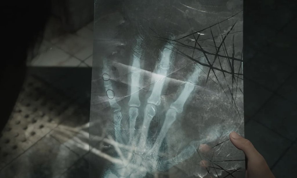 Silent Hill 2 головоломка с рукой в больнице брукхейвен