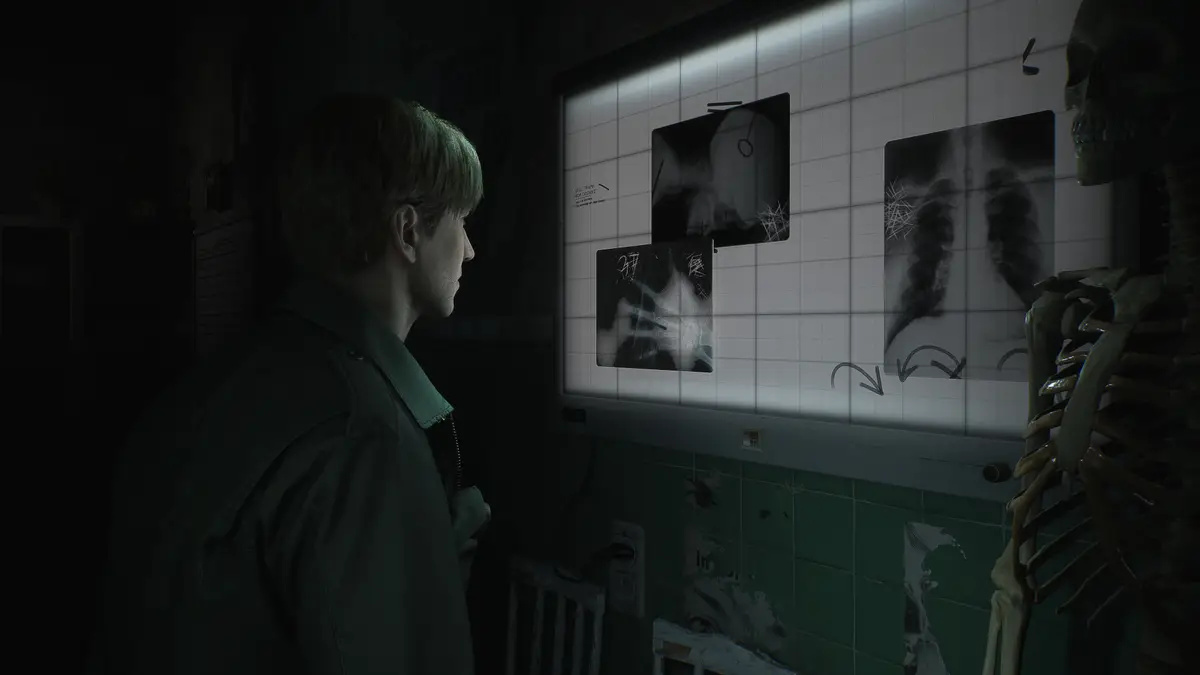 Опубликован геймплейный трейлер ремейка Silent Hill 2